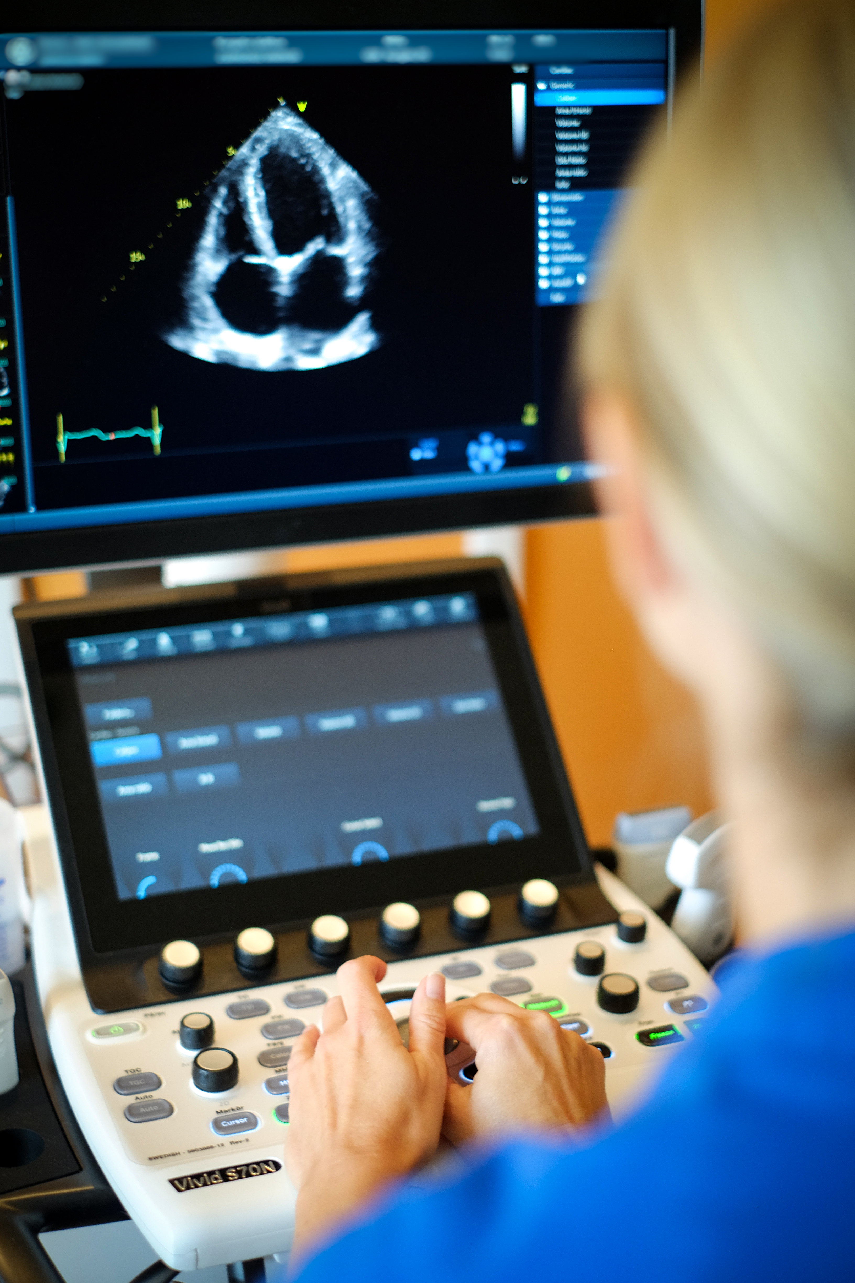 Vårdmedarbetare tittar på skärm som visar ultraljud av hjärta.
